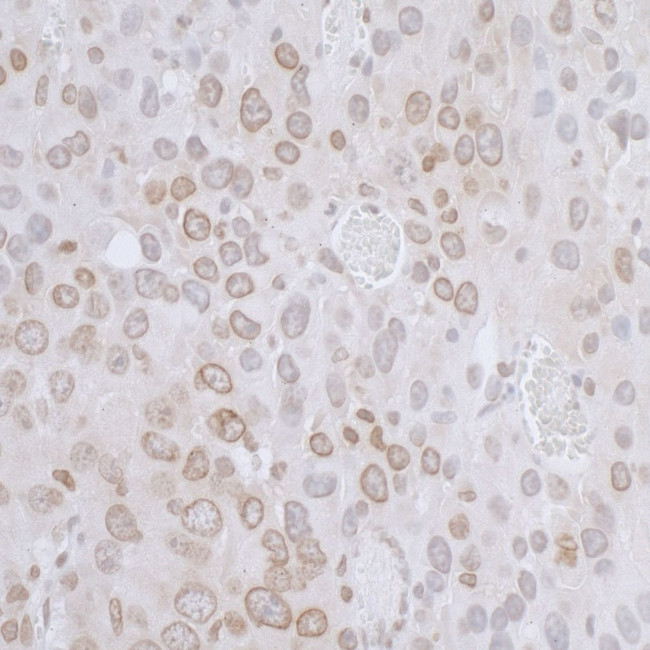 LAP2 beta/TMPO Antibody in Immunohistochemistry (IHC)