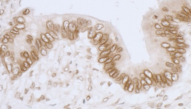 LAP2 beta gamma/TMPO Antibody in Immunohistochemistry (IHC)