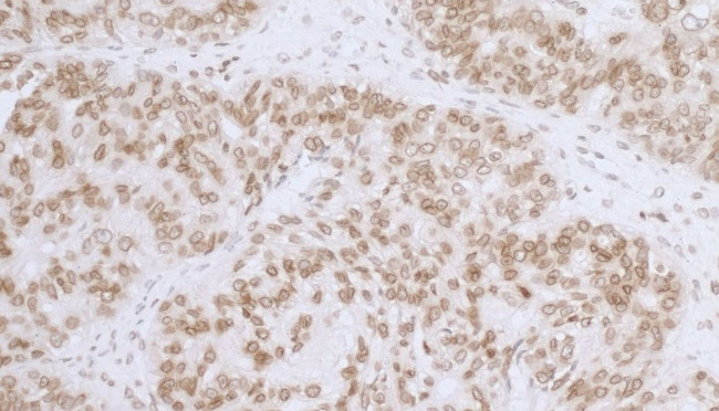 LAP2 beta gamma/TMPO Antibody in Immunohistochemistry (IHC)