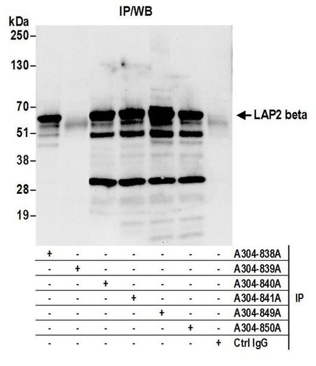 LAP2 beta gamma/TMPO Antibody in Western Blot (WB)