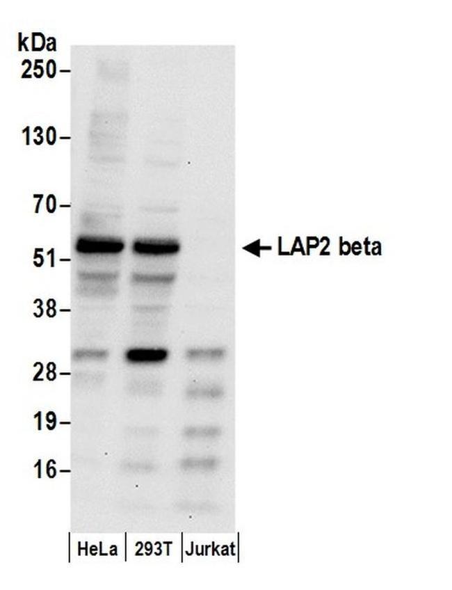 LAP2 beta gamma/TMPO Antibody in Western Blot (WB)