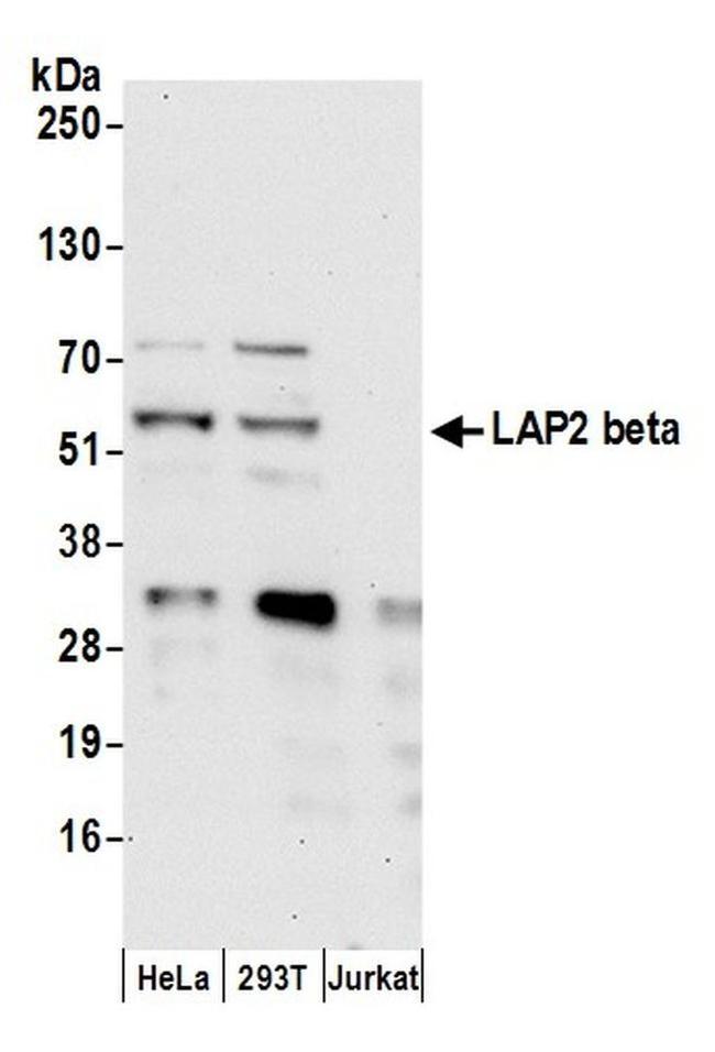 LAP2 beta gamma/TMPO Antibody in Western Blot (WB)