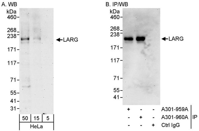 LARG Antibody in Western Blot (WB)