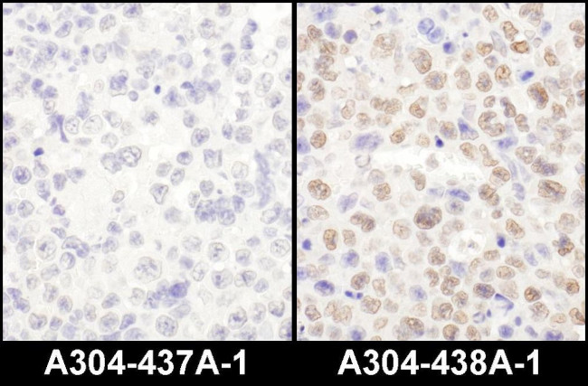 LAS1L Antibody in Immunohistochemistry (IHC)