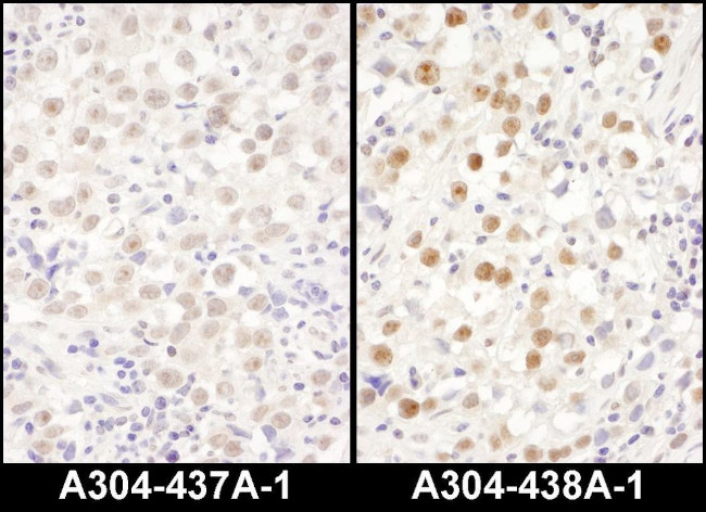 LAS1L Antibody in Immunohistochemistry (IHC)