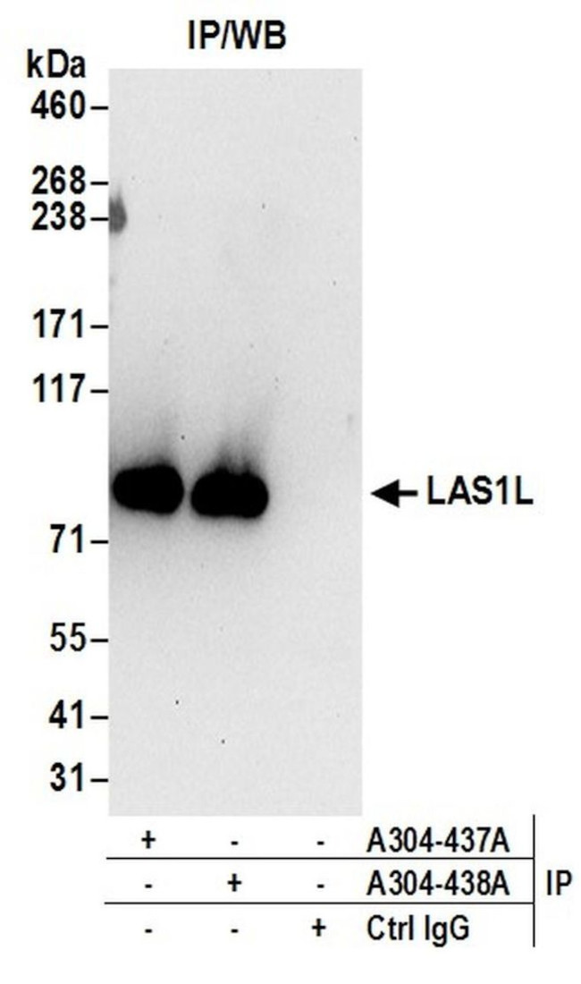 LAS1L Antibody in Immunoprecipitation (IP)