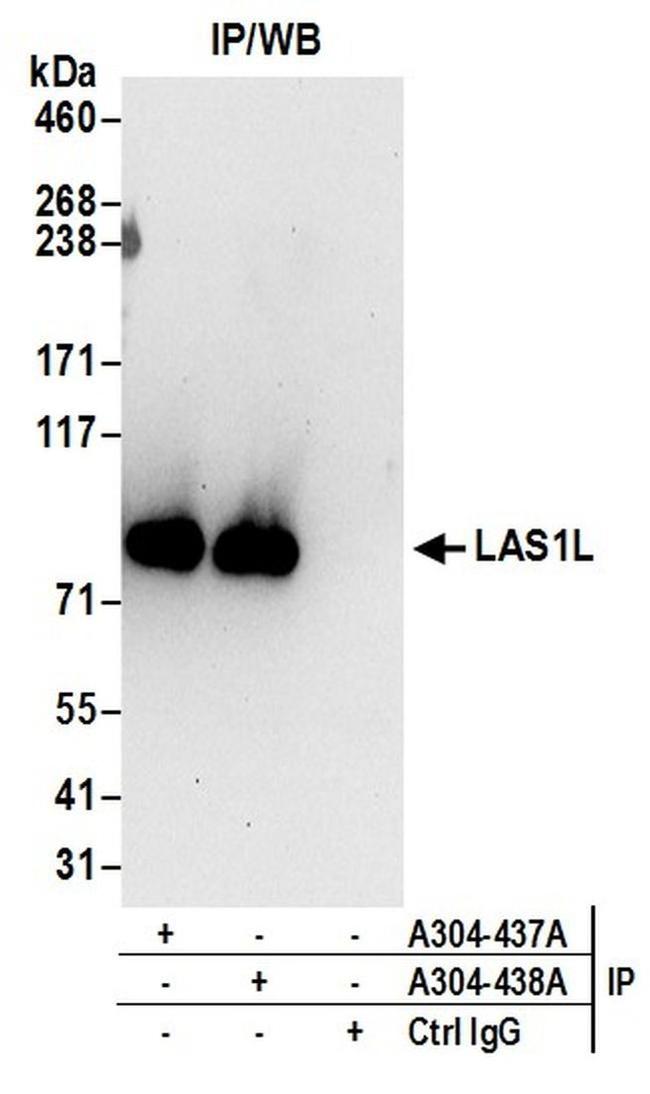 LAS1L Antibody in Western Blot (WB)