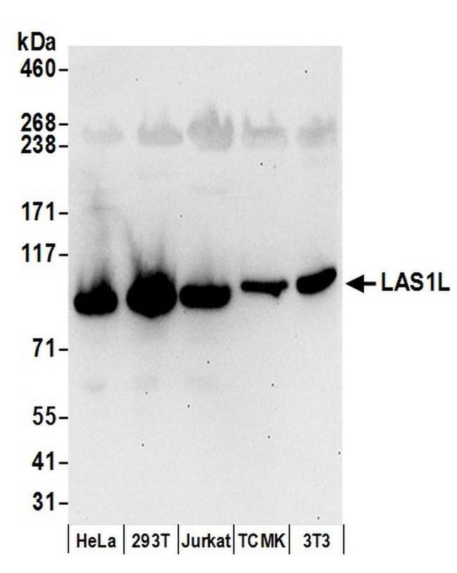 LAS1L Antibody in Western Blot (WB)