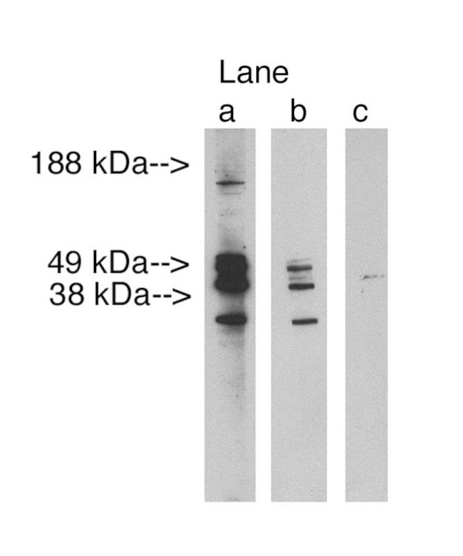 Lass3 Antibody in Western Blot (WB)