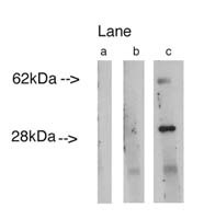 Lass4 Antibody in Western Blot (WB)