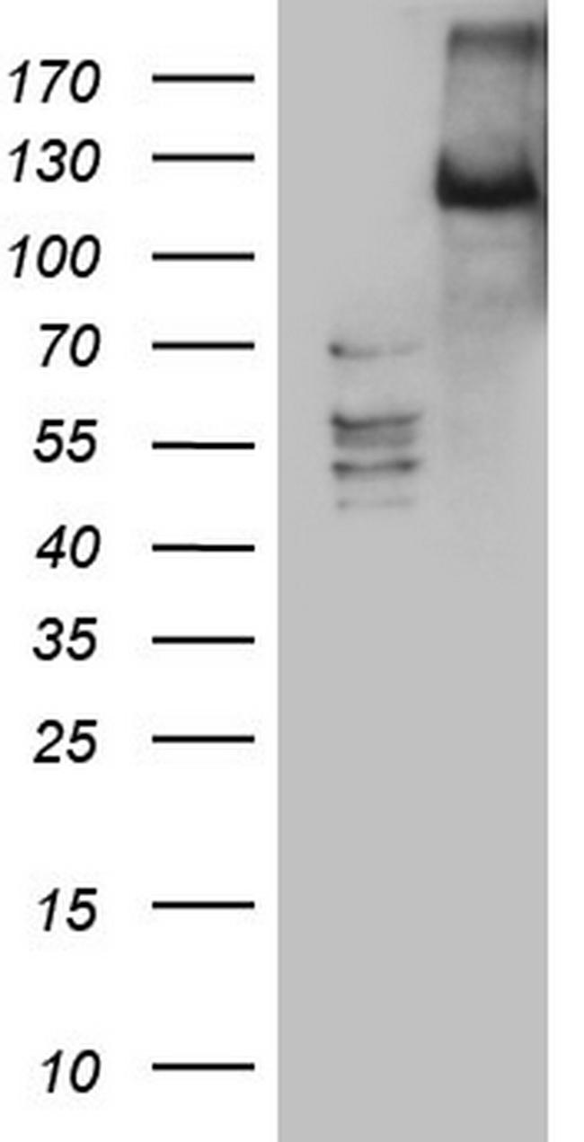LATS2 Antibody in Western Blot (WB)