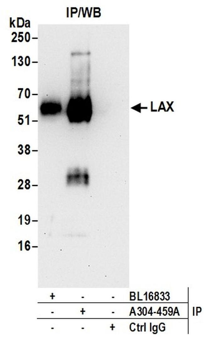 LAX Antibody in Western Blot (WB)