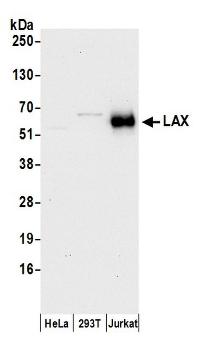 LAX Antibody in Western Blot (WB)