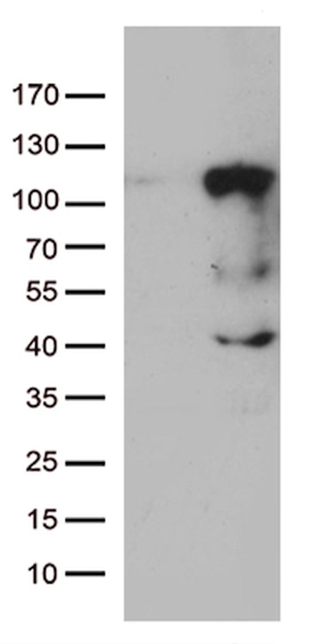 LCA5 Antibody in Western Blot (WB)