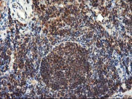 LCMT1 Antibody in Immunohistochemistry (Paraffin) (IHC (P))