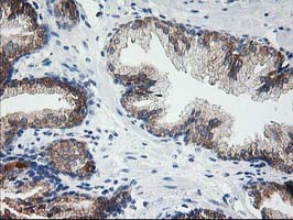 LCMT1 Antibody in Immunohistochemistry (Paraffin) (IHC (P))