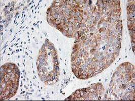 LCMT1 Antibody in Immunohistochemistry (Paraffin) (IHC (P))