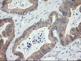 LCMT1 Antibody in Immunohistochemistry (Paraffin) (IHC (P))