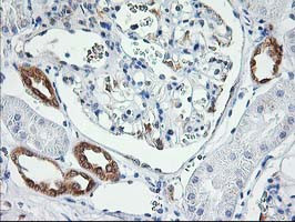 LCMT1 Antibody in Immunohistochemistry (Paraffin) (IHC (P))