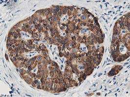 LCMT1 Antibody in Immunohistochemistry (Paraffin) (IHC (P))