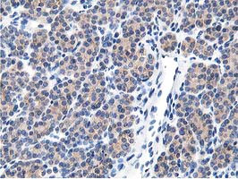 LCMT1 Antibody in Immunohistochemistry (Paraffin) (IHC (P))