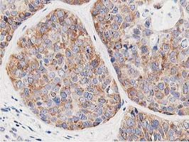 LCMT1 Antibody in Immunohistochemistry (Paraffin) (IHC (P))