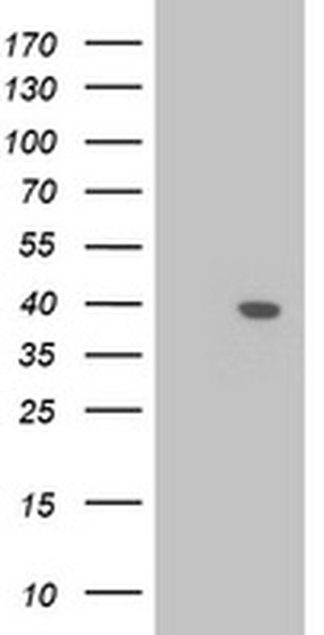 LCMT1 Antibody in Western Blot (WB)