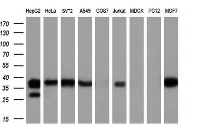 LCMT1 Antibody in Western Blot (WB)