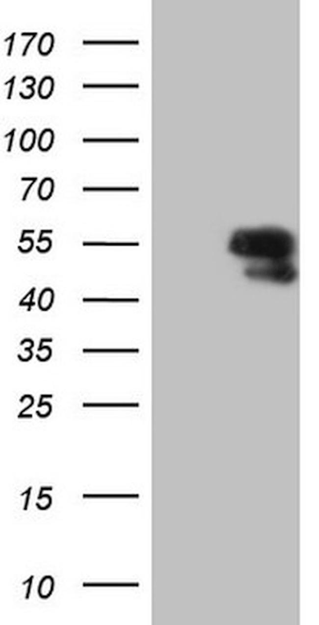 LCOR Antibody in Western Blot (WB)