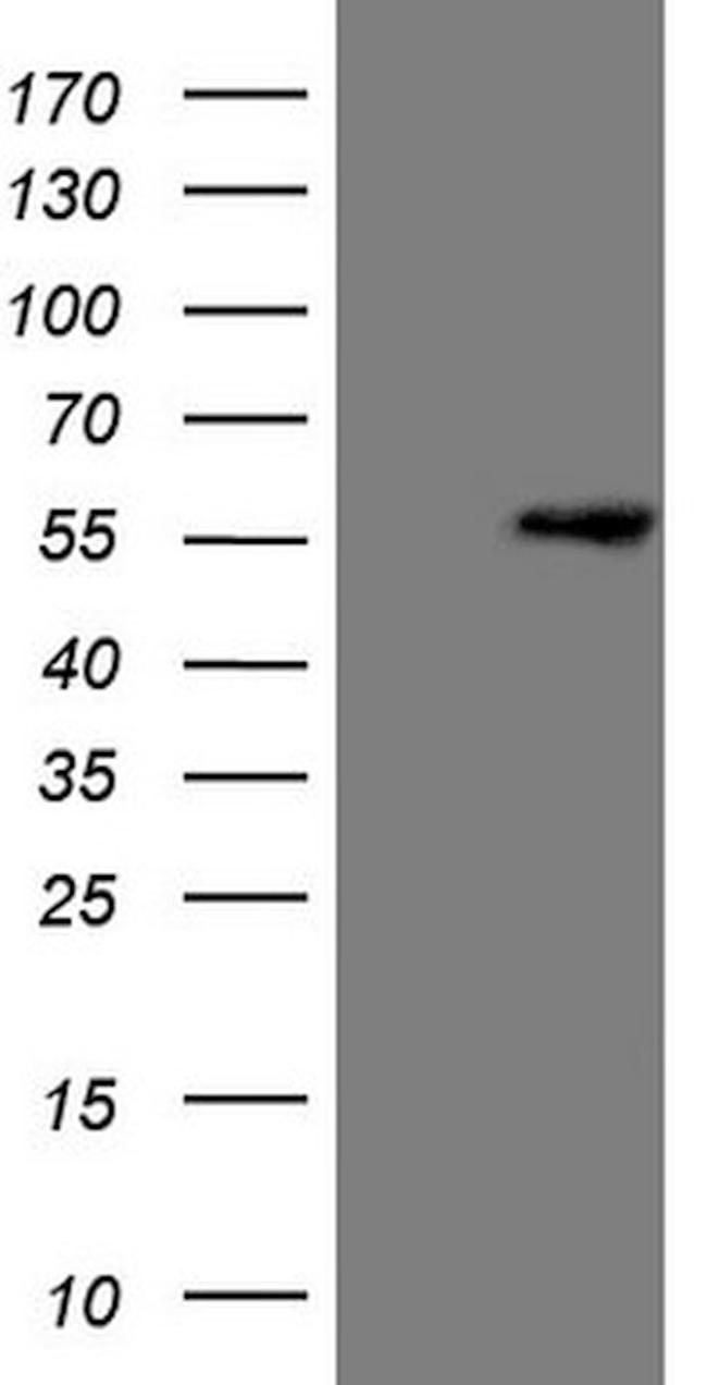 LCOR Antibody in Western Blot (WB)