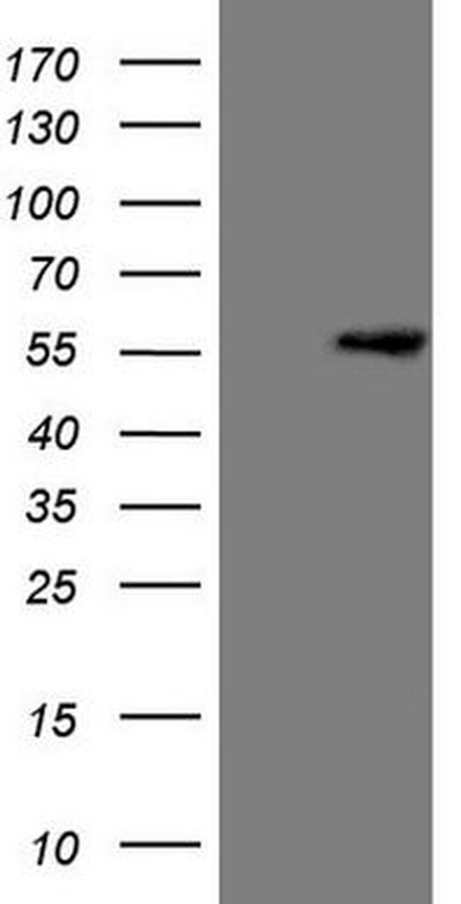 LCOR Antibody in Western Blot (WB)