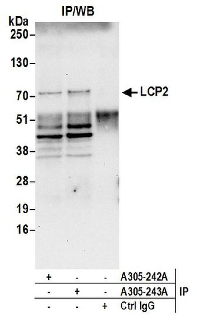 LCP2/SLP76 Antibody in Western Blot (WB)