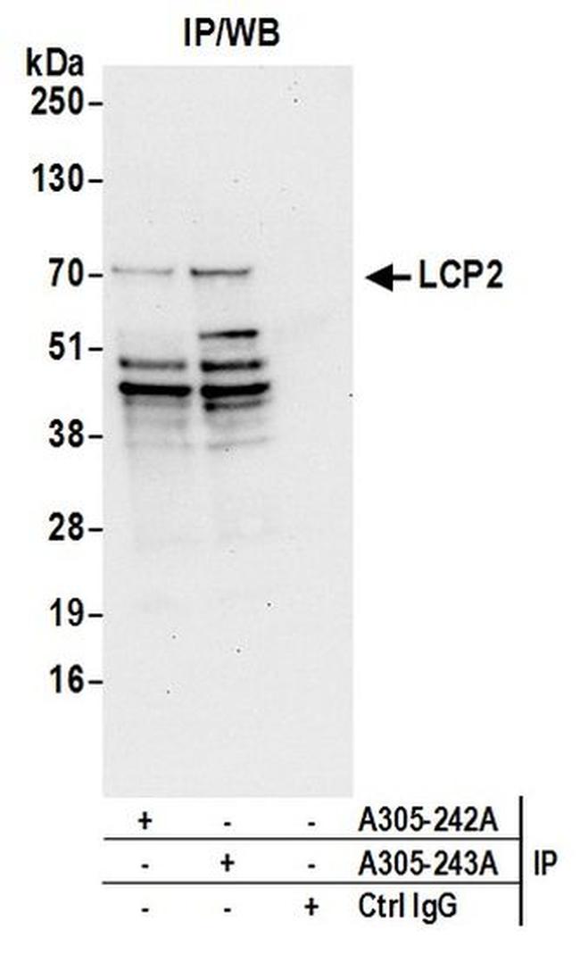 LCP2/SLP76 Antibody in Western Blot (WB)