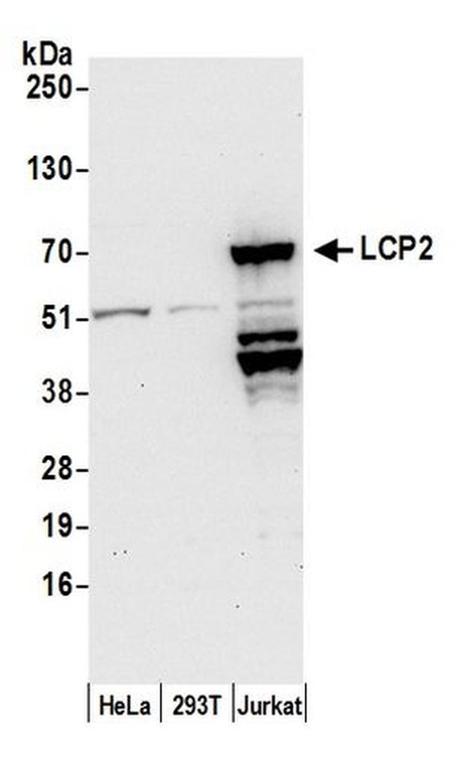 LCP2/SLP76 Antibody in Western Blot (WB)