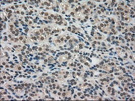 LDHA Antibody in Immunohistochemistry (Paraffin) (IHC (P))