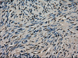 LDHA Antibody in Immunohistochemistry (Paraffin) (IHC (P))