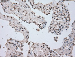 LDHA Antibody in Immunohistochemistry (Paraffin) (IHC (P))