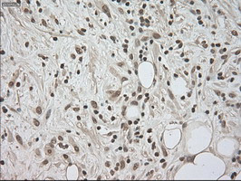 LDHA Antibody in Immunohistochemistry (Paraffin) (IHC (P))