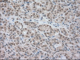 LDHA Antibody in Immunohistochemistry (Paraffin) (IHC (P))