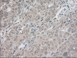 LDHA Antibody in Immunohistochemistry (Paraffin) (IHC (P))