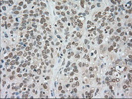 LDHA Antibody in Immunohistochemistry (Paraffin) (IHC (P))