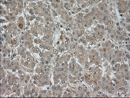 LDHA Antibody in Immunohistochemistry (Paraffin) (IHC (P))