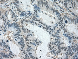 LDHA Antibody in Immunohistochemistry (Paraffin) (IHC (P))