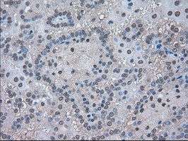 LDHA Antibody in Immunohistochemistry (Paraffin) (IHC (P))