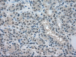 LDHA Antibody in Immunohistochemistry (Paraffin) (IHC (P))