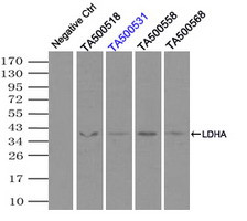 LDHA Antibody in Immunoprecipitation (IP)