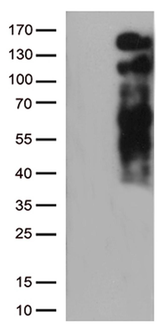 LDLR Antibody in Western Blot (WB)