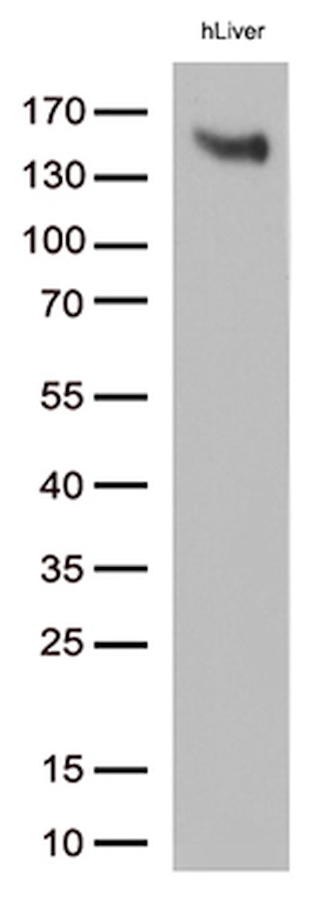 LDLR Antibody in Western Blot (WB)