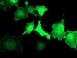 LDLRAP1 Antibody in Immunocytochemistry (ICC/IF)