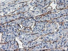 LDLRAP1 Antibody in Immunohistochemistry (Paraffin) (IHC (P))